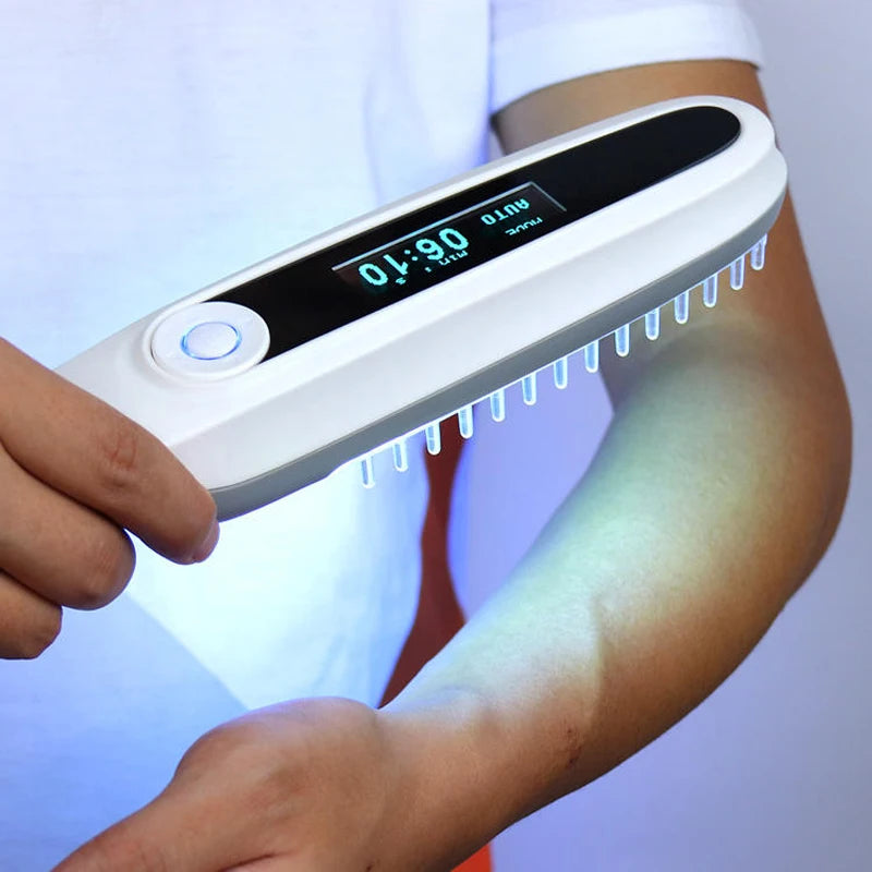 311nm UVB Narrowband Light Source, Portable Ultraviolet Phototherapy Lamp for Skin Care - Bond Well Supplies