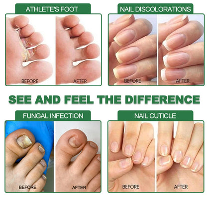 Advanced Nail Care Serum, Supports Healthy Nail Appearance