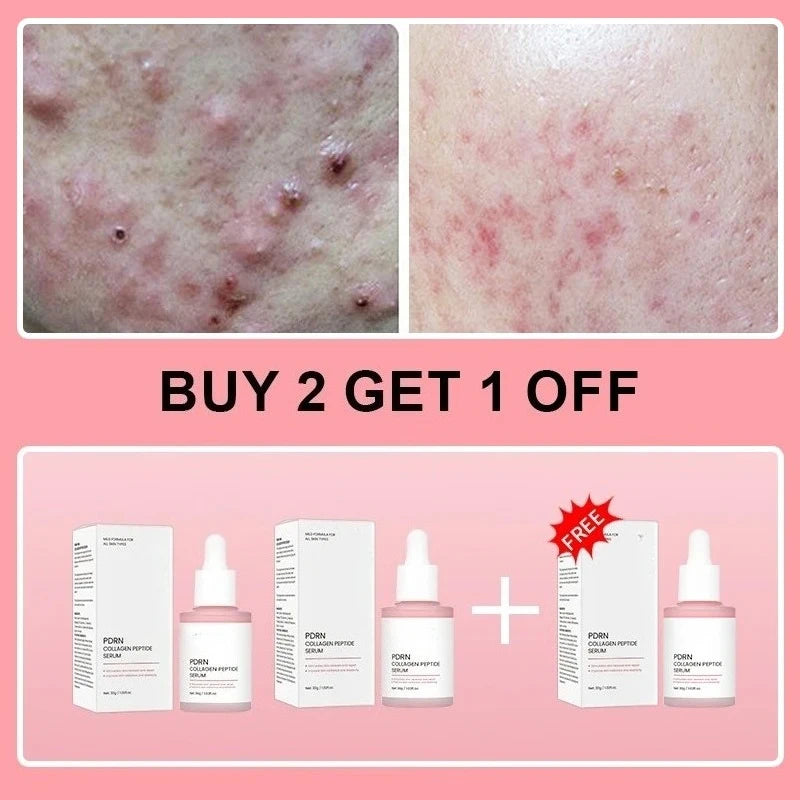 Collagen Peptide Face Serum with Salmon PDRN, Korean Beauty Essence for Skin Renewal & Smoother-Looking Skin - Bond Well Supplies