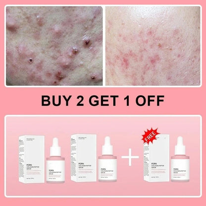 Collagen Peptide Face Serum with Salmon PDRN, Korean Beauty Essence for Skin Renewal & Smoother-Looking Skin - Bond Well Supplies