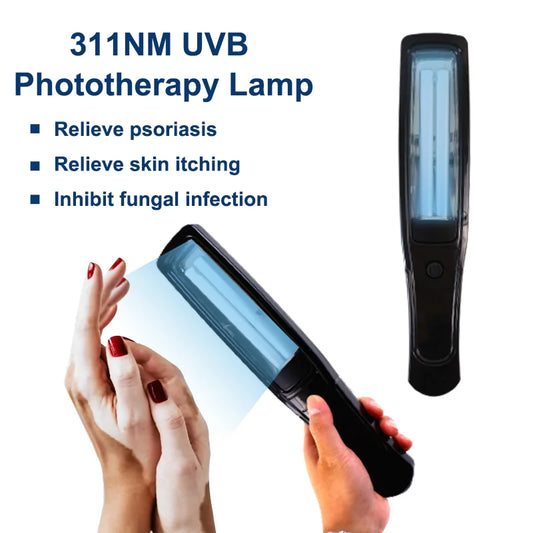 311nm Ultraviolet Phototherapy Instrument, UVB Light Lamp for Targeted Skin Care - Bond Well Supplies