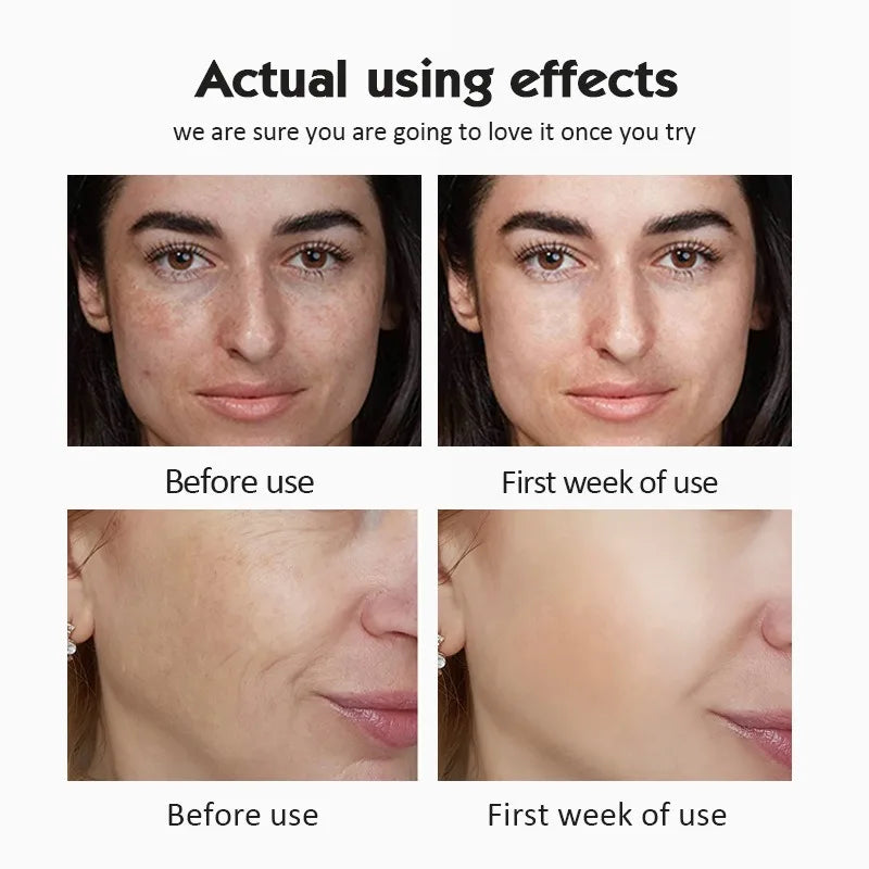 Hydrating Vitamin C Ampoule Serum Set for Daily Facial Skin Care