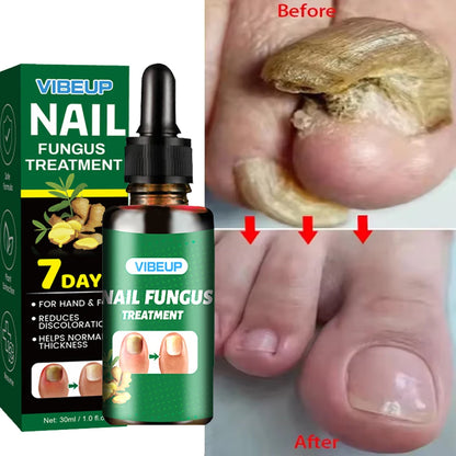 Advanced Nail Care Serum, Supports Healthy Nail Appearance