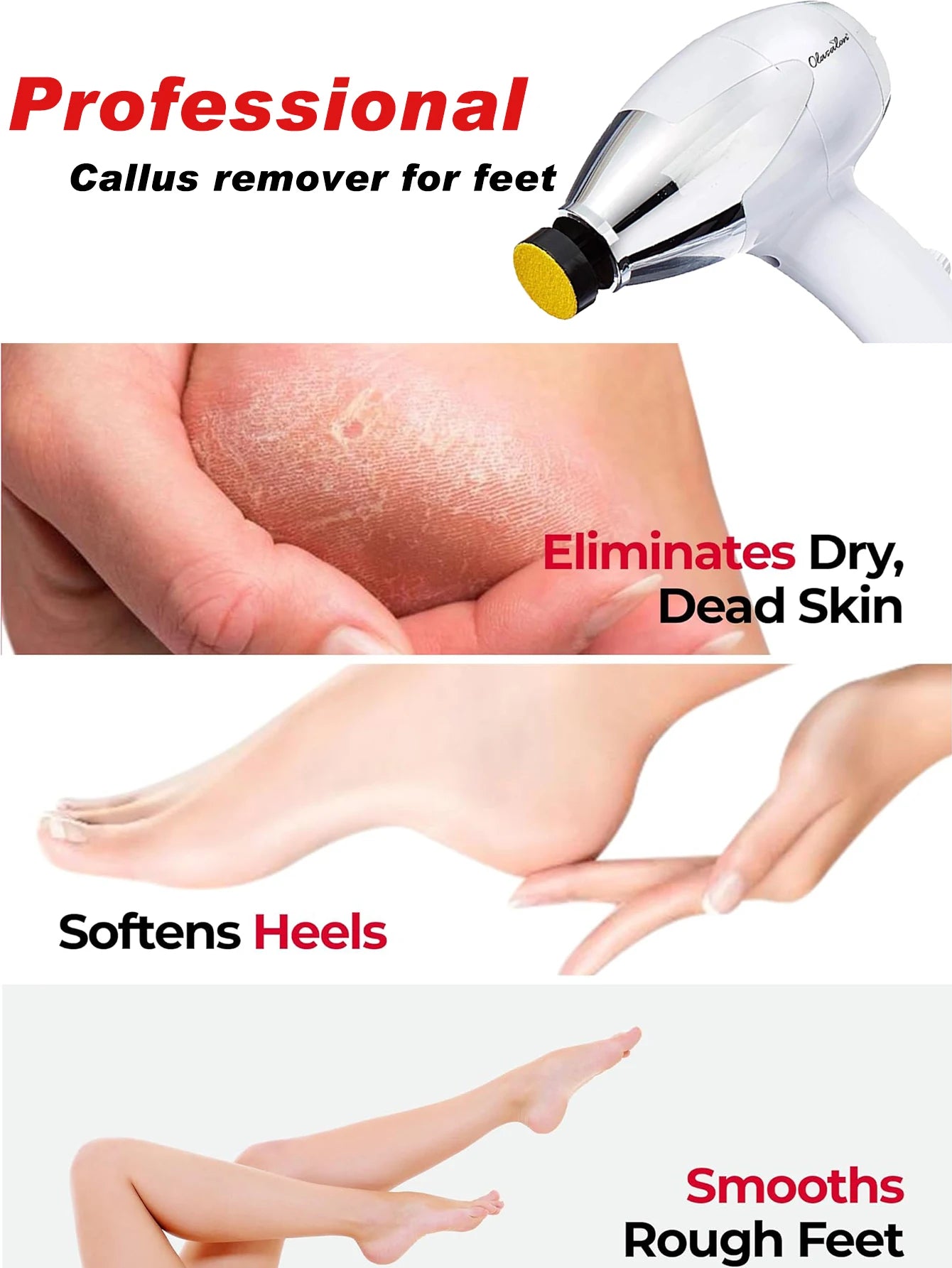 OLASALON Electric Foot Callus Remover, Waterproof Pedicure Tool Set, 110V US Plug