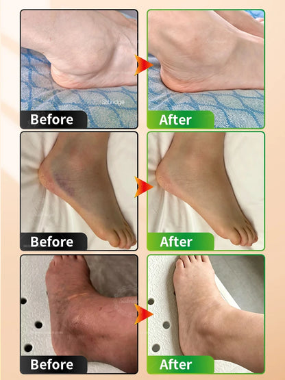 Electric Heated Foot Massager, Ankle Wrap with Multiple Vibration Modes for Home Use