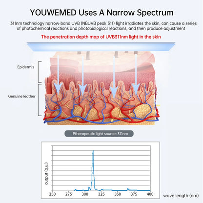 YOUWEMED 311nm UVB Phototherapy Lamp for Targeted Skin Care
