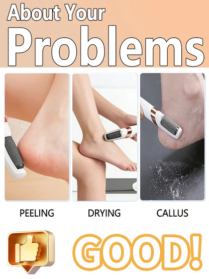 Electric Callus Remover for Feet, Foot Grinder and Exfoliator for Dry, Rough Skin