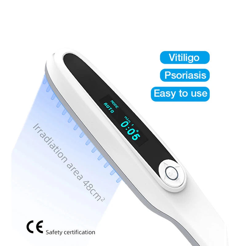 311nm UVB Narrowband Light Source, Portable Ultraviolet Phototherapy Lamp for Skin Care - Bond Well Supplies