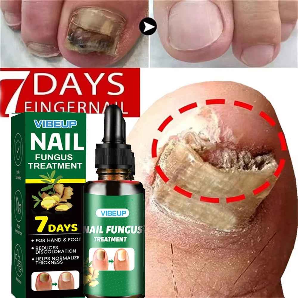 Advanced Nail Care Serum, Supports Healthy Nail Appearance