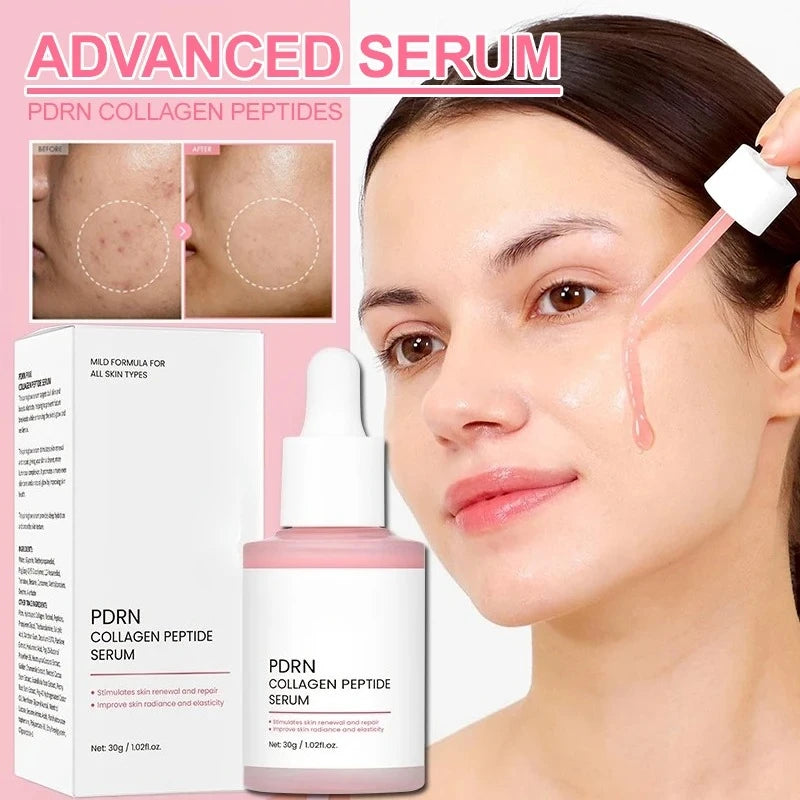 Collagen Peptide Face Serum with Salmon PDRN, Korean Beauty Essence for Skin Renewal & Smoother-Looking Skin - Bond Well Supplies
