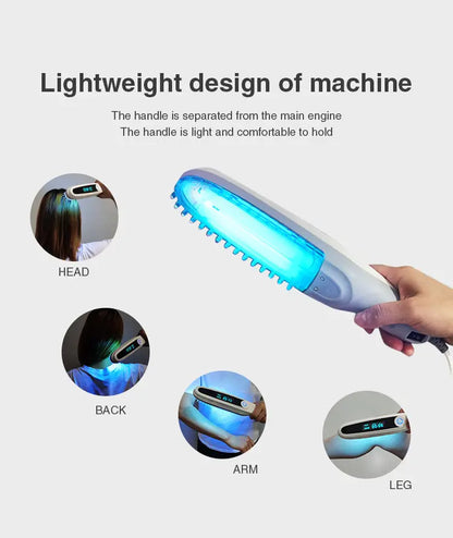 311nm UVB Narrowband Light Source, Portable Ultraviolet Phototherapy Lamp for Skin Care - Bond Well Supplies