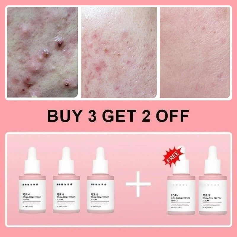 Collagen Peptide Face Serum with Salmon PDRN, Korean Beauty Essence for Skin Renewal & Smoother-Looking Skin - Bond Well Supplies