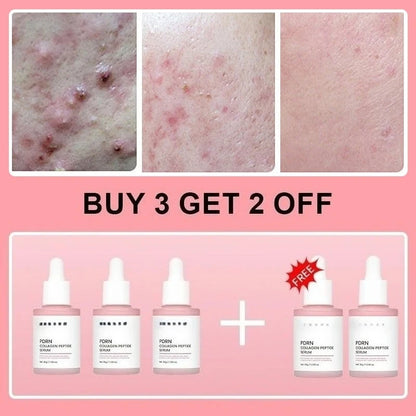 Collagen Peptide Face Serum with Salmon PDRN, Korean Beauty Essence for Skin Renewal & Smoother-Looking Skin - Bond Well Supplies