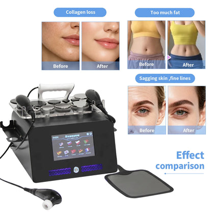 INDIBA 448kHz Beauty Therapy Machine, Thermal Skin Care & Body Care Device for Spa Us - Bond Well Supplies