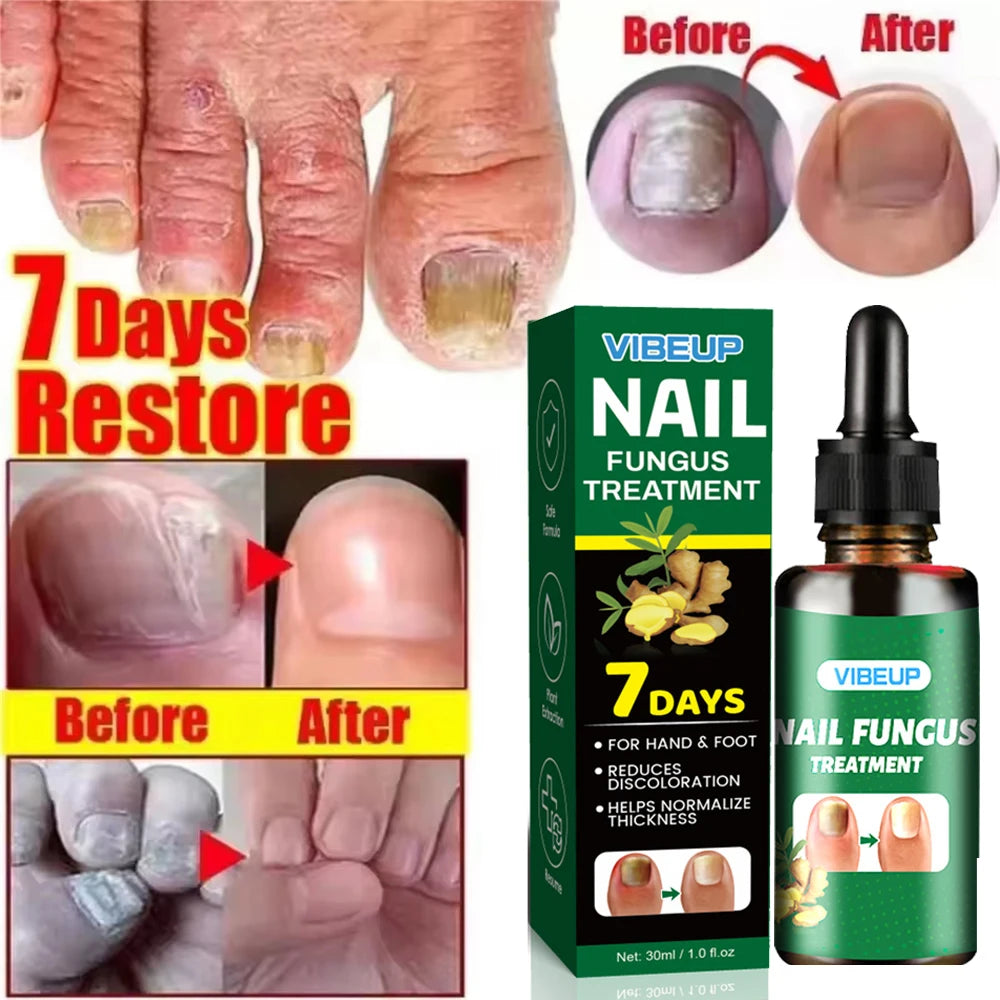 Advanced Nail Care Serum, Supports Healthy Nail Appearance