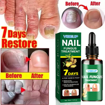 Advanced Nail Care Serum, Supports Healthy Nail Appearance